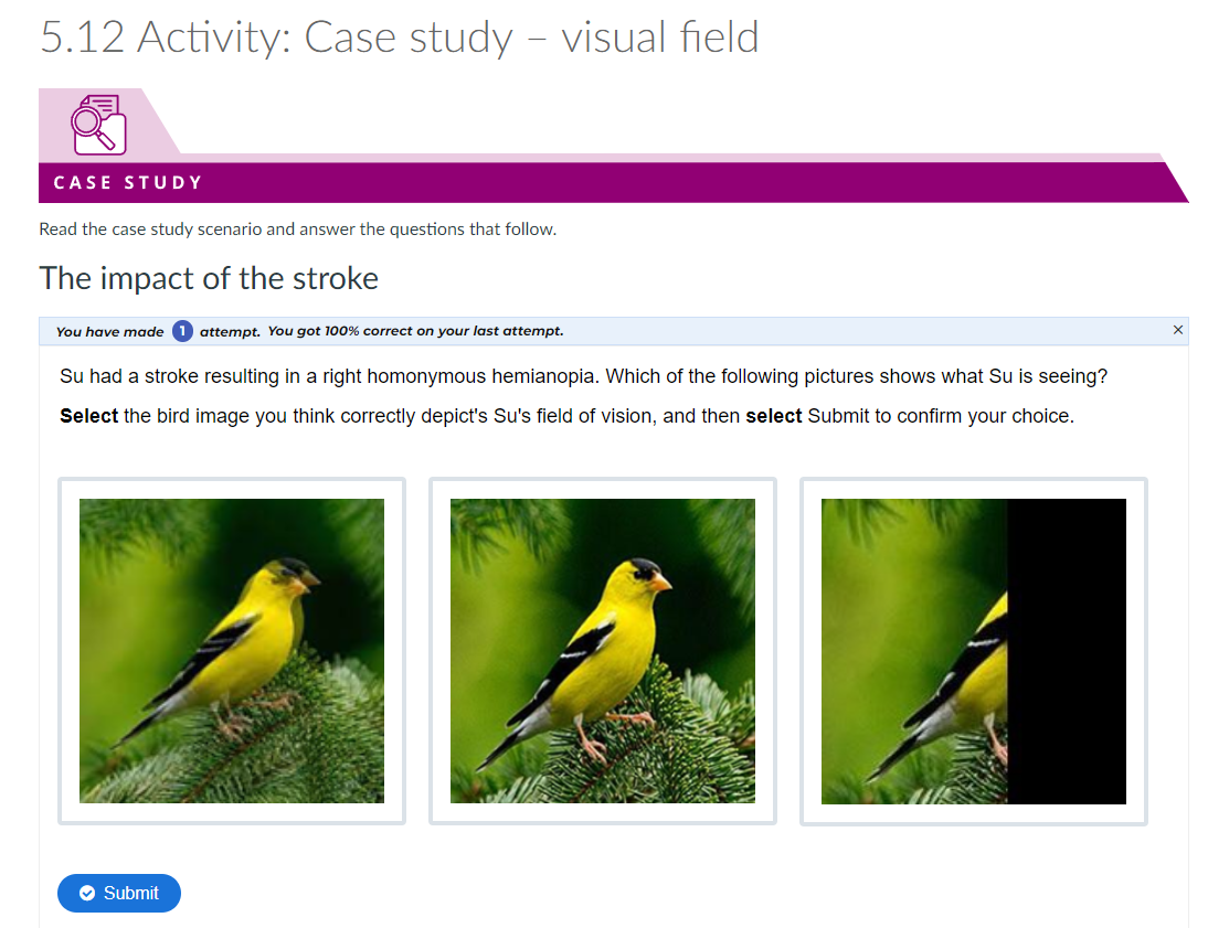 H5P activity for identifying visual defects after stroke